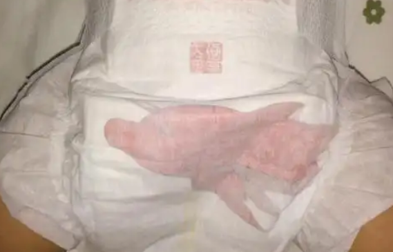 小森林和山茶花选哪个？新手直接抄，拒绝套路